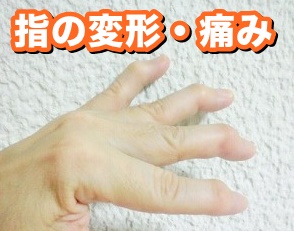 指の変形・痛み